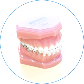 マウスピース矯正