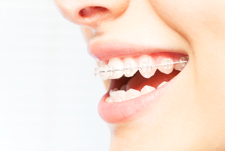 ホワイトワイヤー